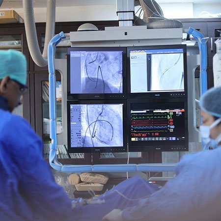 Best Heart Angiography Hospital in Meerut
