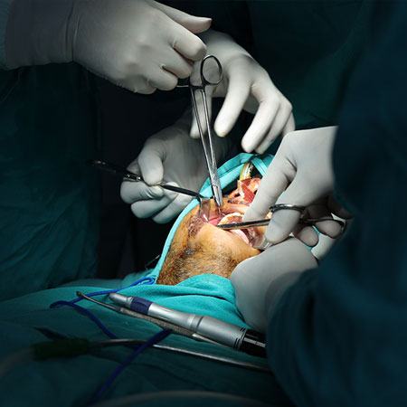 Critical Maxillofacial Surgery Case