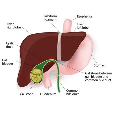 Gallbladder Removal Surgery