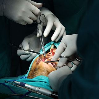 Best Dental Surgeon Meerut